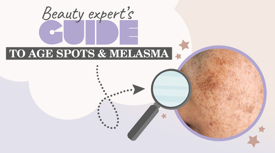 Beauty experts guide to age spots and melasma
