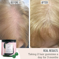 Hair Gain Hair Gummies before and after real results