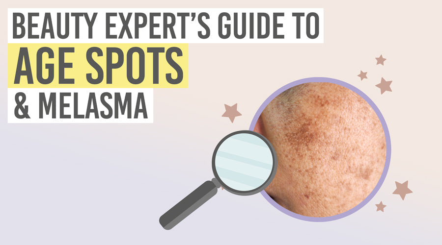 Beauty experts guide to age spots and melasma - Beauty and the Boutique 