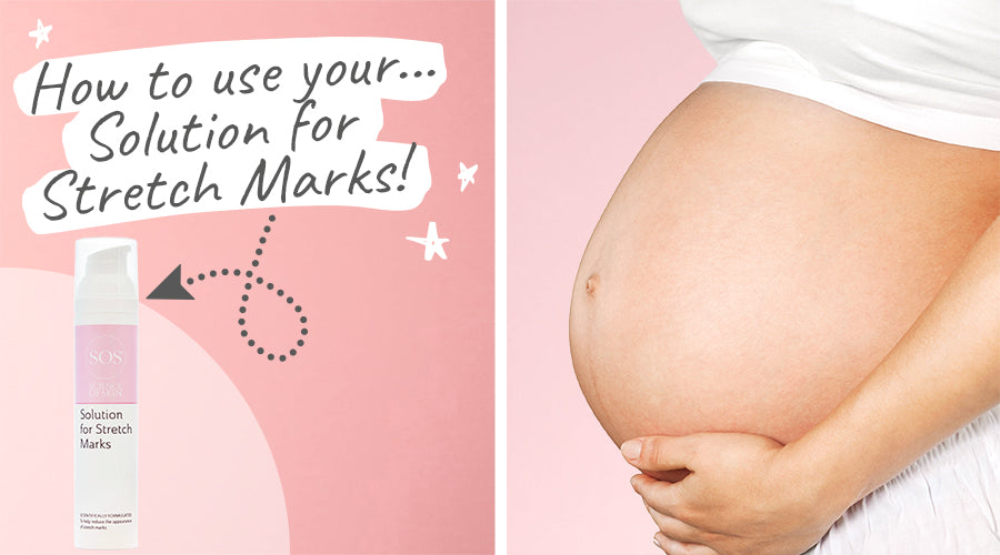 Science of Skincare Solution for Stretch Marks