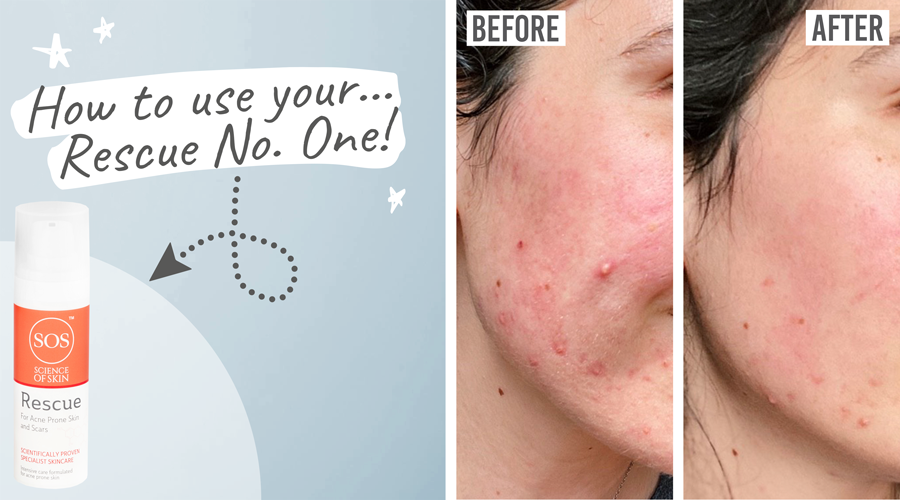 Science of Skin - Rescue No. One