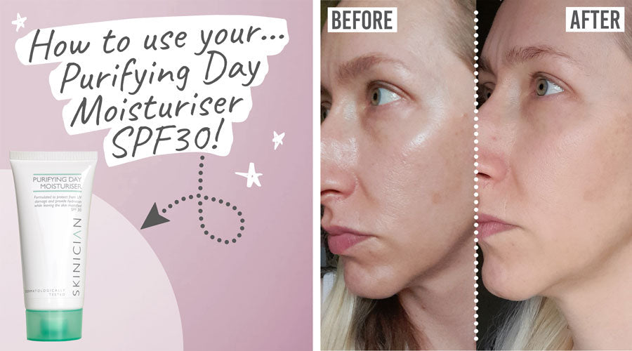 Skinician - Purifying Day Moisturiser SPF30