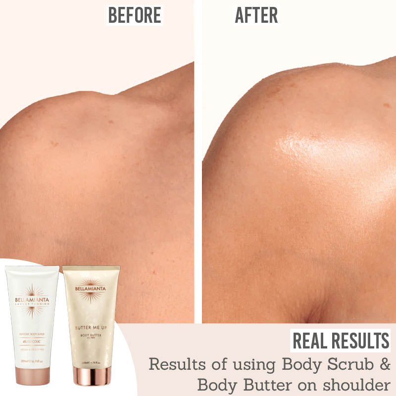Bellamianta Smoothing Body Duo - Before and After real results on shoulder