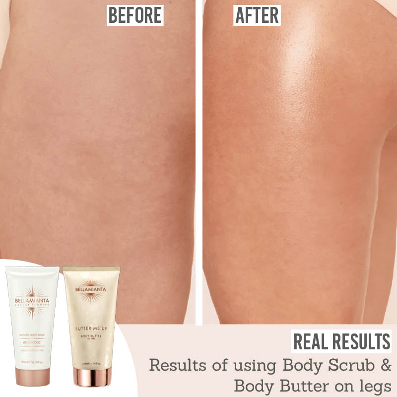 Bellamianta Smoothing Body Duo - Before and After real results on legs