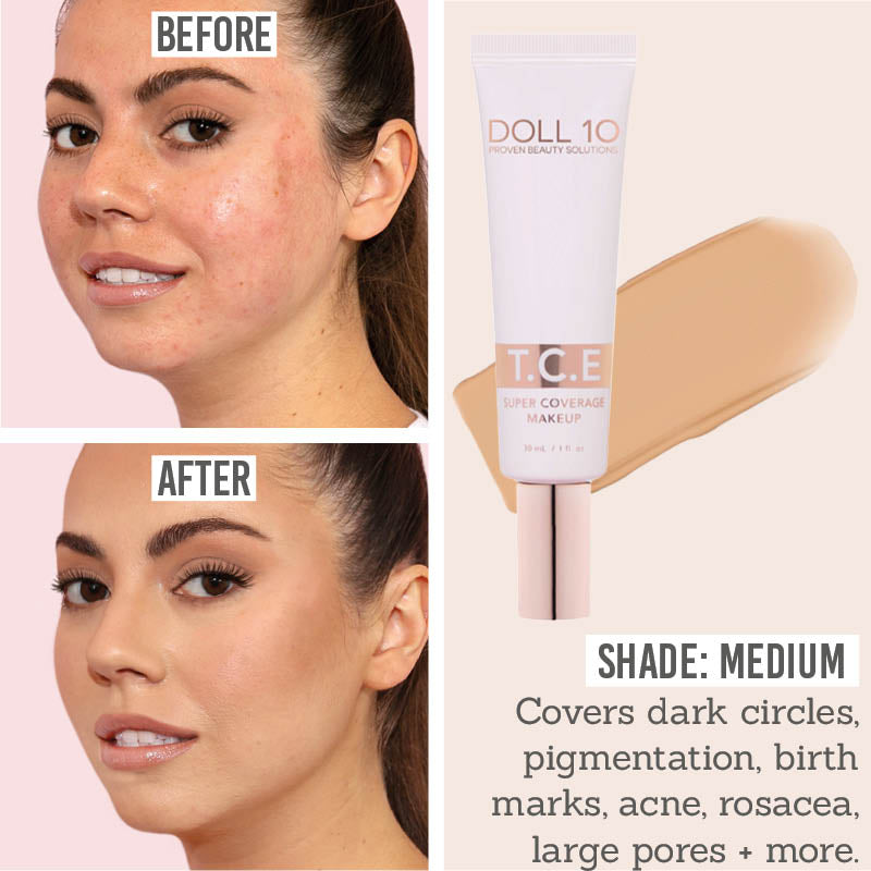 Doll 10 T.C.E. Super Coverage Serum Foundation before and after results on medium skin tones