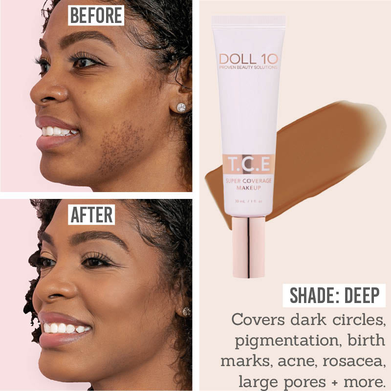 Doll 10 T.C.E. Super Coverage Serum Foundation before and after results on dark skin tones