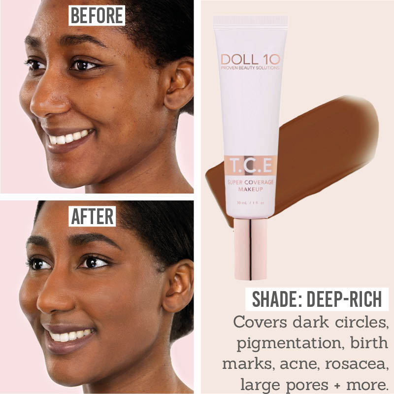 Doll 10 T.C.E. Super Coverage Serum Foundation before and after results on deep skin tones
