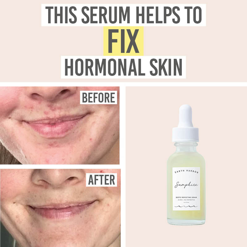 Earth Harbor Samphire Biotic Perfecting Serum - Beauty and the Boutique - This serum helps to fix hormonal skin