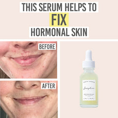 Earth Harbor Samphire Biotic Perfecting Serum - Beauty and the Boutique - This serum helps to fix hormonal skin