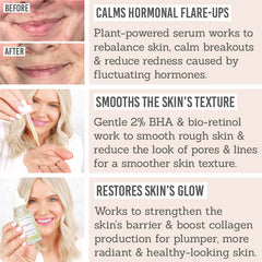 Earth Harbor Samphire Biotic Perfecting Serum key benefits - Calms hormonal flare-ups, smooths the skin's texture, restores skin's glow