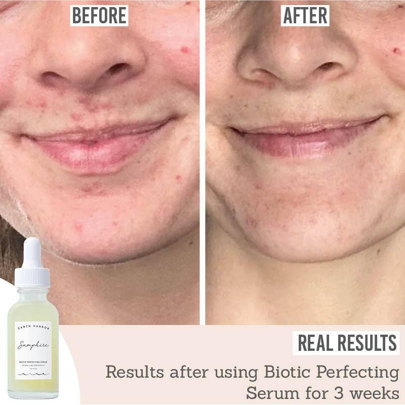 Earth Harbor Samphire Biotic Perfecting Serum before and after results after using for 3 weeks