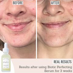 Earth Harbor Samphire Biotic Perfecting Serum before and after results after using for 3 weeks