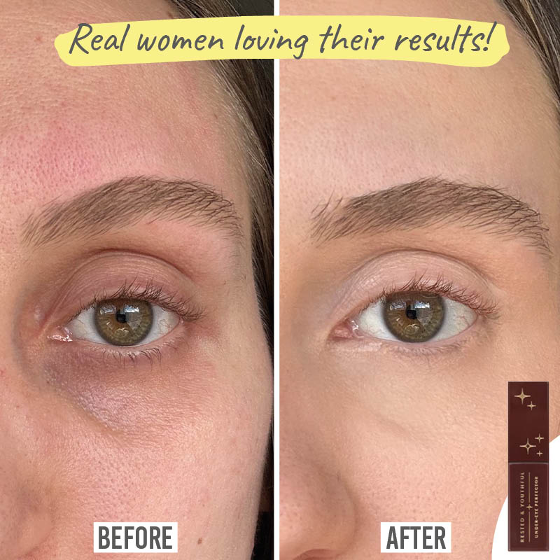 Love Katie Rested and Youthful Under-Eye Perfector real women before and after results on Shannon