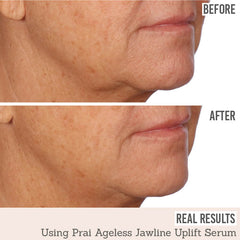 Prai Ageless Jawline Uplift Serum before and after results