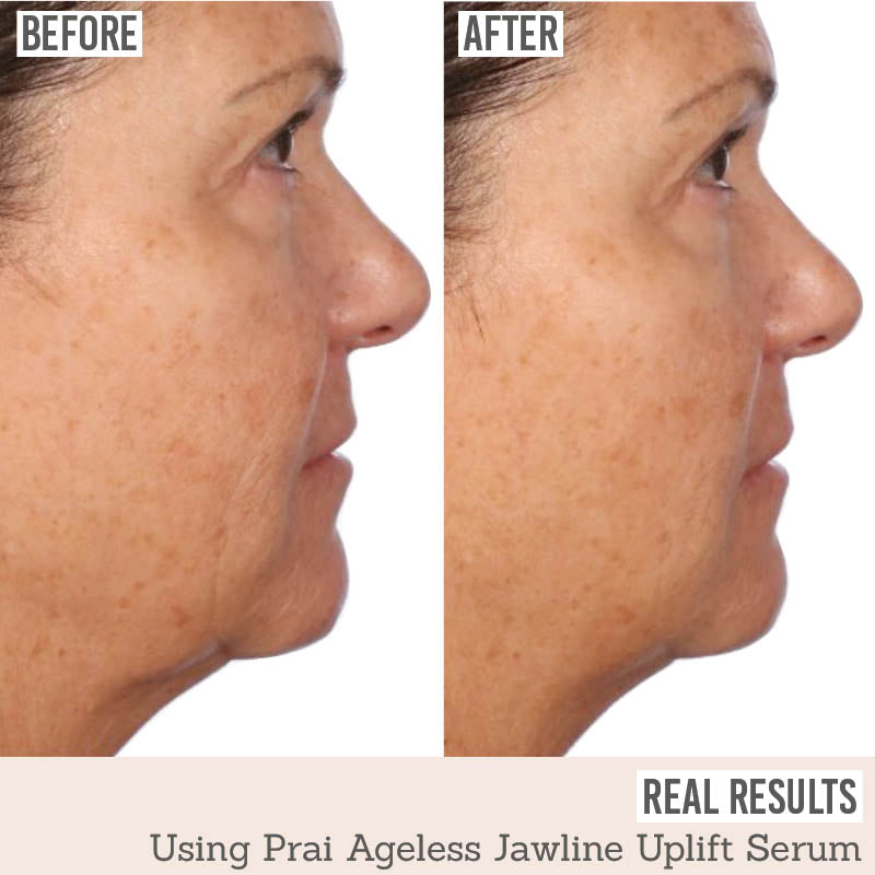 Prai Ageless Jawline Uplift Serum before and after results