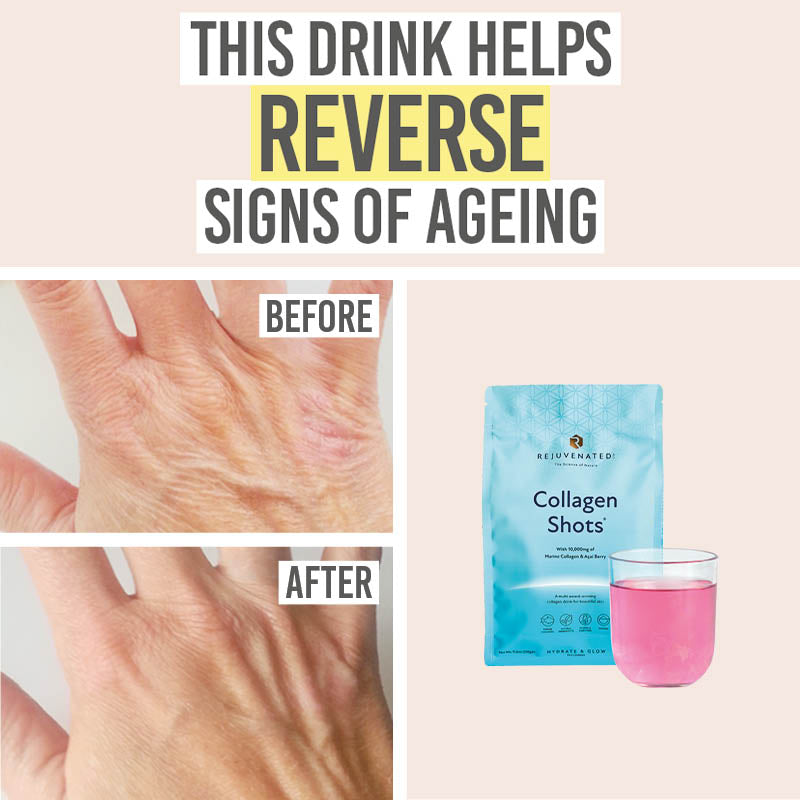 Skin Shot Rejuvenated Collagen Shots | Plumps, Hydrates & Firms Skin – Beauty and ...