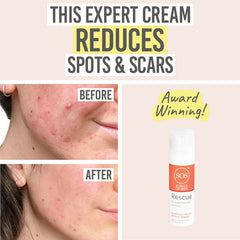 Science of Skincare Rescue Before and After Results