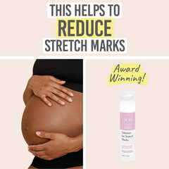 Science of Skincare Solutions for Stretch Marks