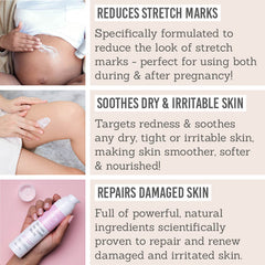 Benefits of Science of Skincare Solution for Stretch Marks