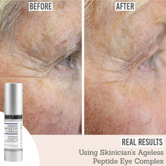 Skinician Ageless Peptide Eye Complex before and after results