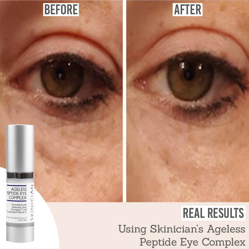 Skinician Ageless Peptide Eye Complex before and after results
