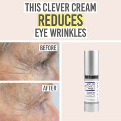 Skinician Ageless Peptide Eye Complex Before and After