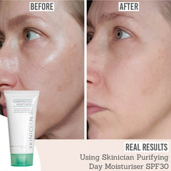 Real results from using Skinician Purifying Day Moisturiser