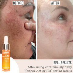 Skinician Vitamin C Elixir before and after results