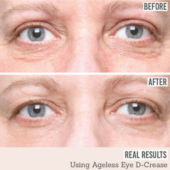 Prai Ageless Eye D-Crease before and after results