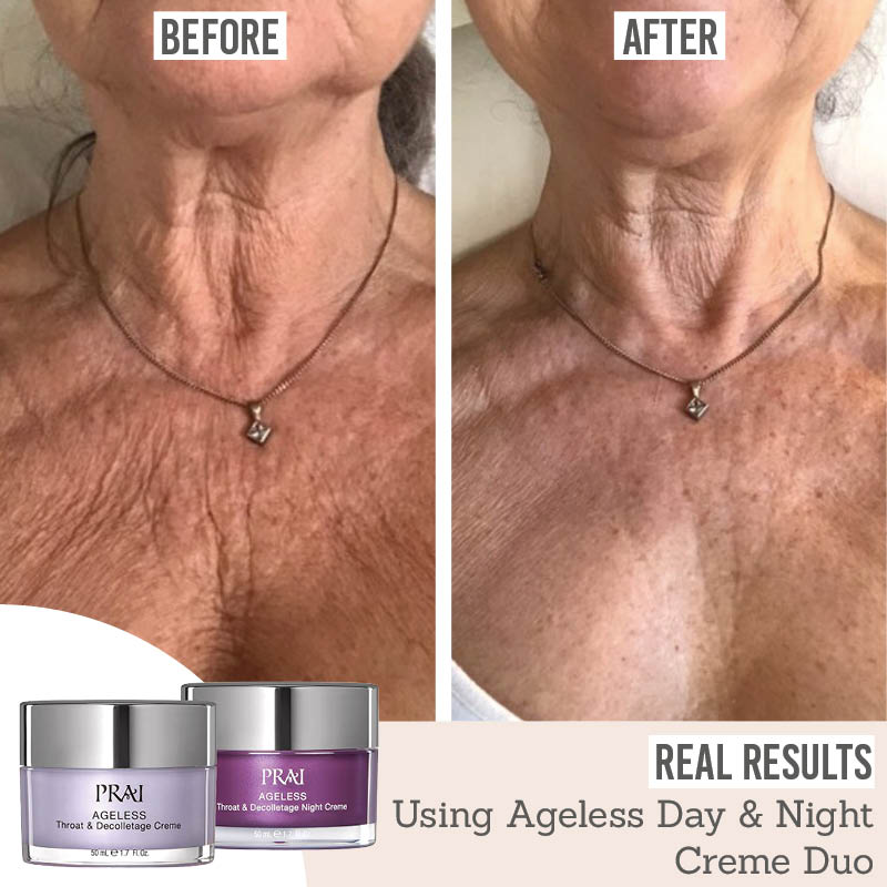 Prai Ageless Throat & Décolletage Day & Night Creme Duo before and after results