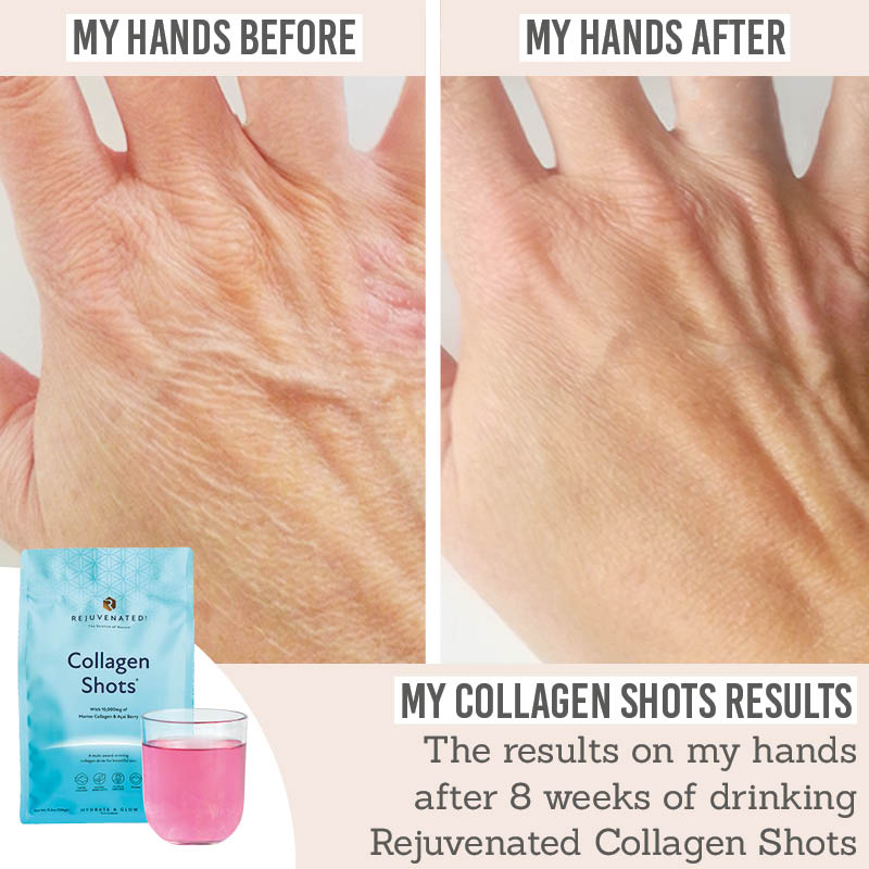 Skin Shot Rejuvenated Collagen Shots | Plumps, Hydrates & Firms Skin – Beauty and ...