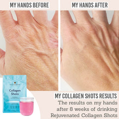 Before and after results of Rejuvenated Collagen Shots