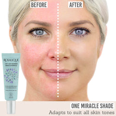 Rosalique 3 in 1 Anti Redness Miracle Formula before and after results